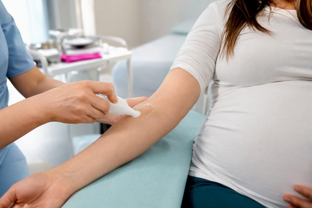 ¿Puede el gel de ultrasonido causar alergia en la piel?
