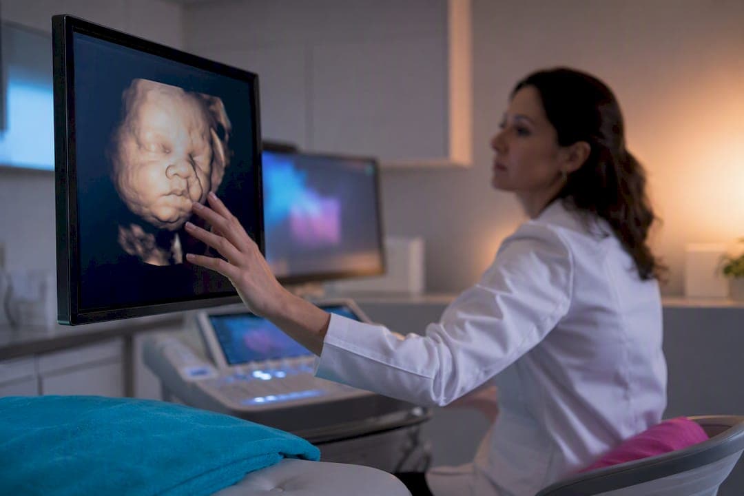 El labio leporino 3D: cómo la tecnología cambia el diagnóstico prenatal